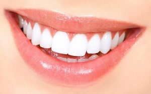teeth bleaching results 1 1